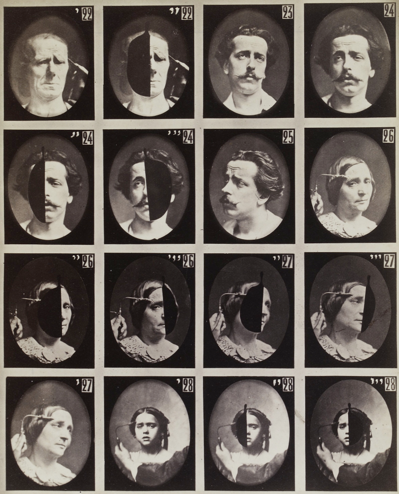 Illustration for article titled Terrifying, Century-Old Photographs from Neuroscience Experiments